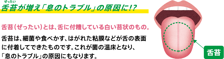 舌苔が増え「息のトラブル」の原因に!?舌苔（ぜったい）とは、シタに付糟している白い苔状のもの。舌苔は、細菌や食べかす、はがれた粘膜などが舌の表面に付着してできたものです。これが菌の温床となり、「息のトラブル」の原因にもなります。